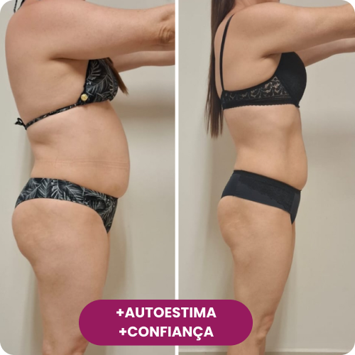 Transformação real de aluna do Reativa 2